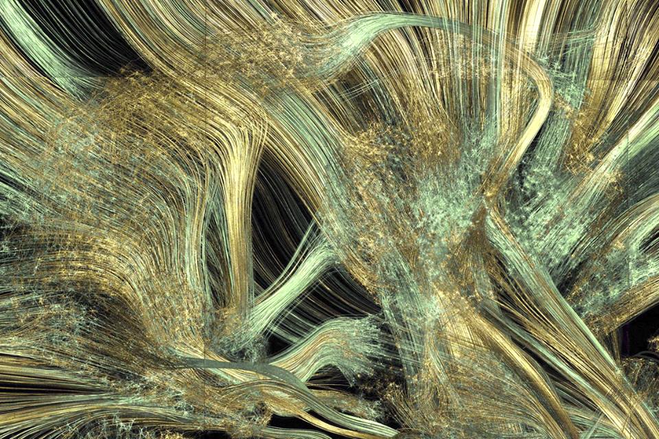 Наш мозок зблизька: неповторна краса, що заворожує